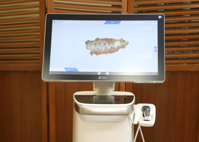 inta-oral-scanner image
