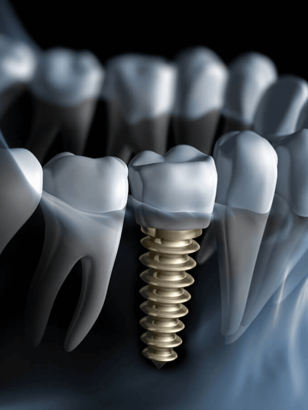 best dentist in agra